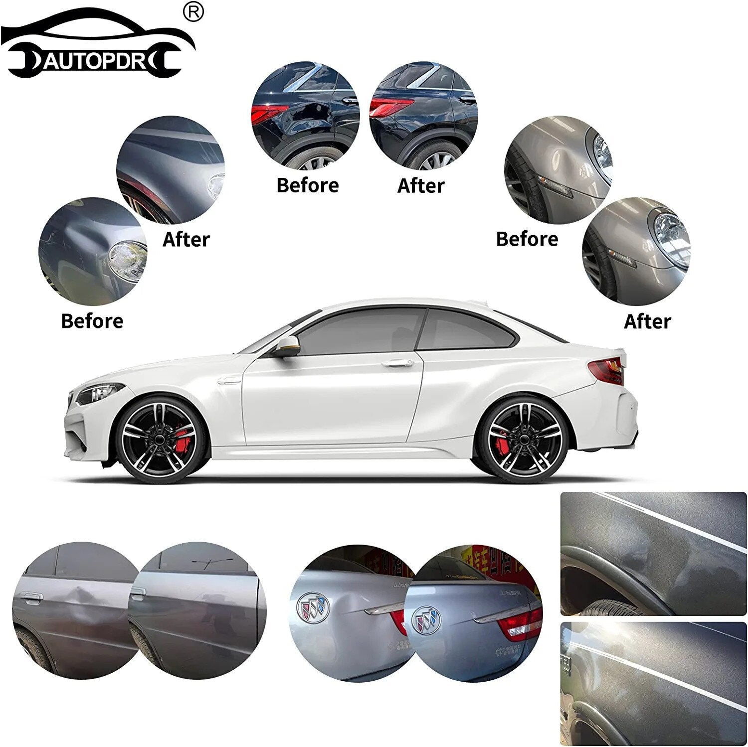 Master Car Dent Repair with Super PDR Dent Removal Kit